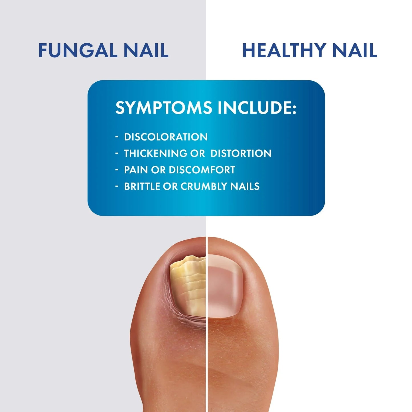 ProClearz Fungal Shield – Max Strength Antifungal Brush-On Liquid, 1 oz - Exotic Pro