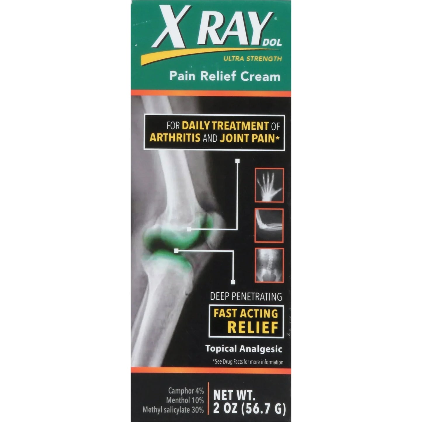 X Ray Dol Ultra Strength Pain Relief Cream for Arthritis & Muscle Pain, 2 oz - Exotic Pro